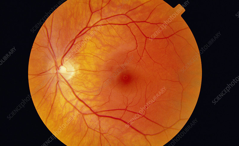 retina institutes