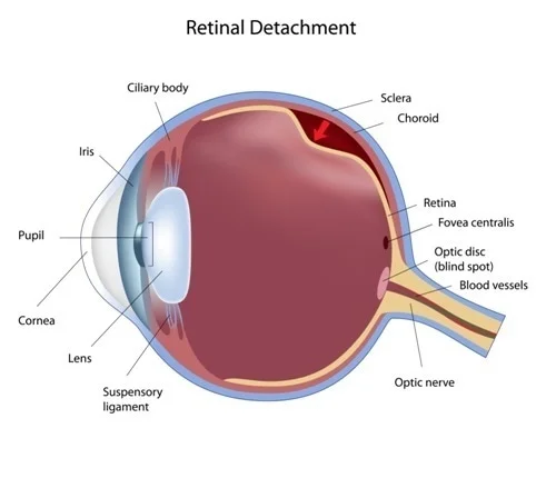 retina institute